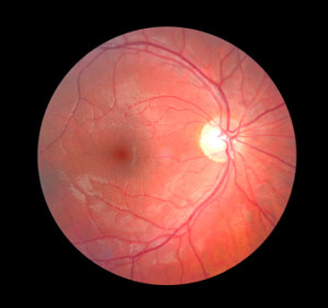 Retina (iStock image) Retinal Photograph inside the eye.