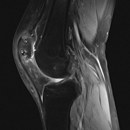 Bekathwia, Flickr, cc knee-mri-bekathwia-on-flickr