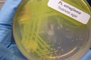 Pseudomonas_aeruginosa_culture