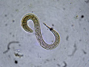 Larval Strogyloides stercoralis from a faecal sample. Image taken by blogger Yuri