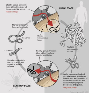 Life cycle of Onchocerca volvulus: wiki commons image