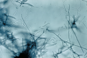 Streptomyces sp