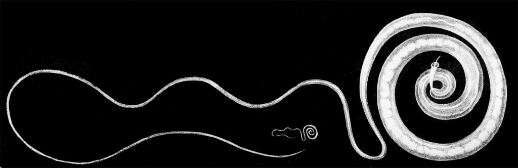Trichuris trichiura Source: Wikki commons