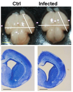 Images showing the smaller size of mouse brains infected with ZIKV relative to the mock infected (control, Ctrl). Lower panel: sections of the same brains. Source: http://0-www.sciencedirect.com.brum.beds.ac.uk/science/article/pii/S1934590916300844