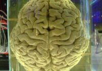 brain