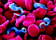 trypanosomes
