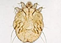 Sarcoptes_scabiei
