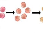 Colorectal cancer progression is linear. The alternative model of progression that are cancer types follow is branched evolution, when there may be many different clones occurring at the same time.