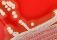 Bacterial colonies.