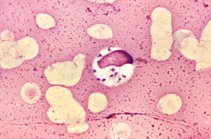 Leishmania donovani - credit CDC