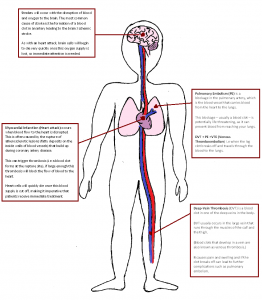 Thrombosis facts