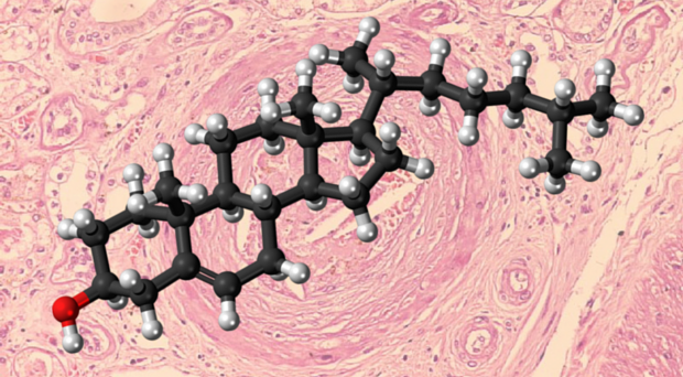 Cholesterol molecule