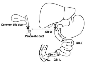The biliary diversion procedure