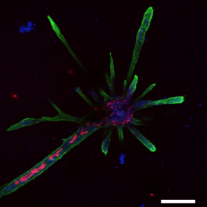 The red cells are luminal cells located inside the external network of green myoepithelial cells, and they form tubes through which milk can flow during lactation