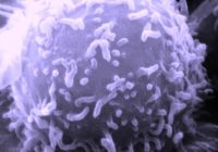 lymphocyte